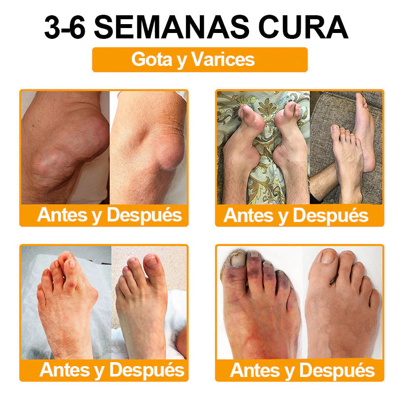 ODALIT™ Toxina Botulínica & Veneno de Abeja Alivio del Dolor Crema Cicatrizante de Huesos