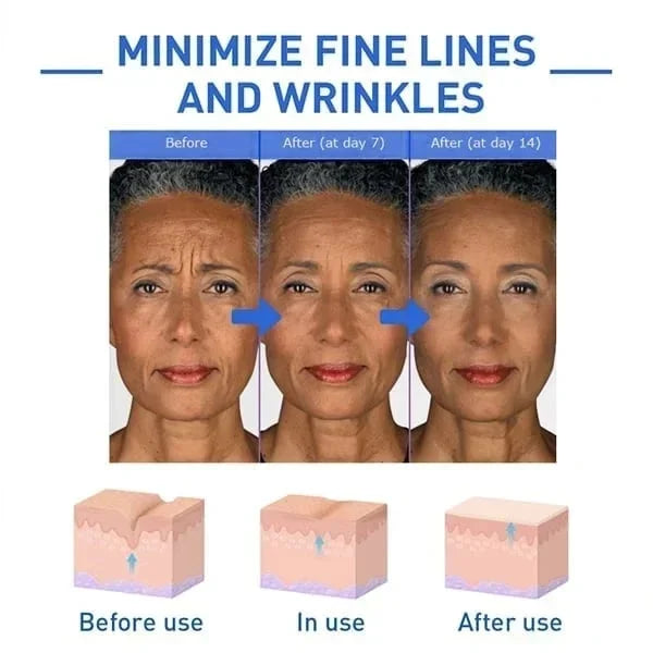 Last Day Promotion 49% OFF - đ„Botox Face Serum