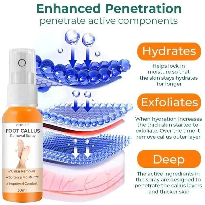 Foot Callus Removal Spray | Buy 1 + Get 1 Free