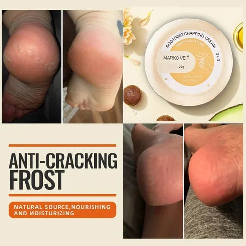 đSALE-49% OFFđAnti-Cracking Frost