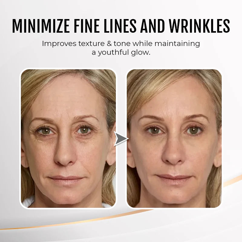 đ„ Last Day Discount: 88% OFFđInstant Wrinkle Eye Tightener cream