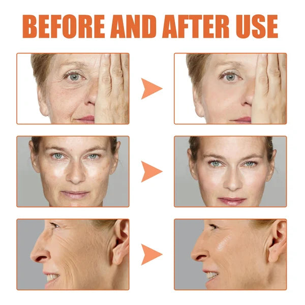 đBuy 1 Get 1 Freeđ - Botox Face Serum