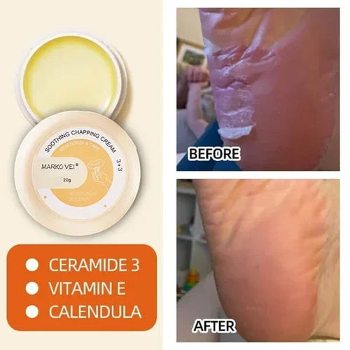 đSALE-49% OFFđAnti-Cracking Frost