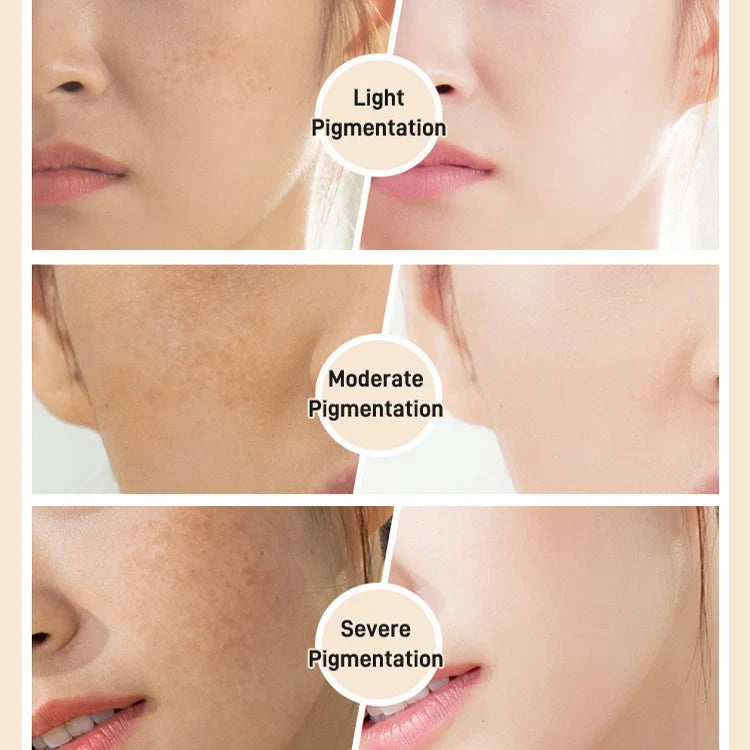 Intensive Whitening and Anti-Blemish Serum Oil