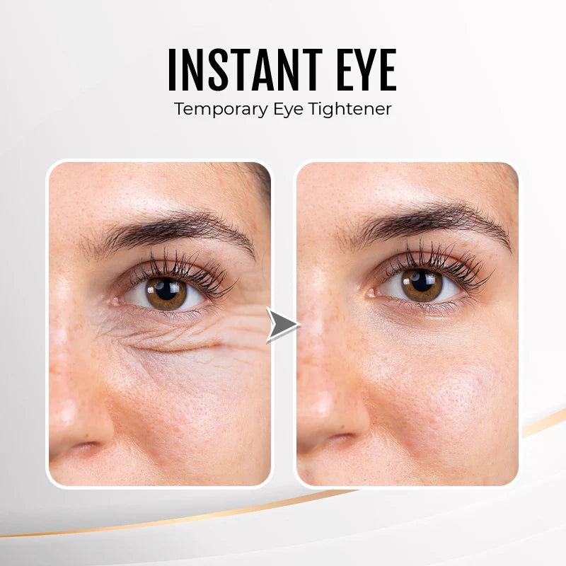 đ„ Last Day Discount: 88% OFFđInstant Wrinkle Eye Tightener cream
