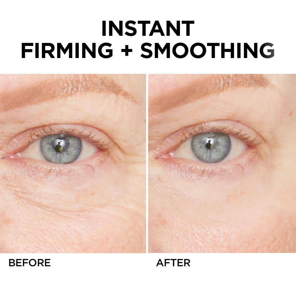 đ„ Last Day Discount: 88% OFFđInstant Wrinkle Eye Tightener cream