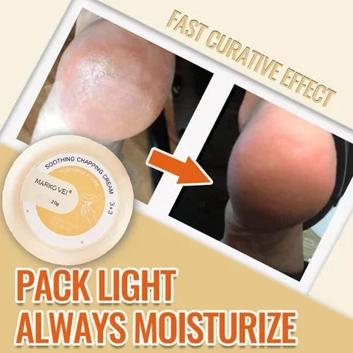 đSALE-49% OFFđAnti-Cracking Frost