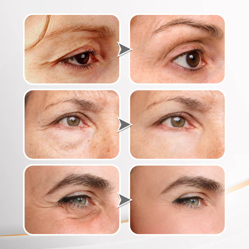 đ„ Last Day Discount: 88% OFFđInstant Wrinkle Eye Tightener cream