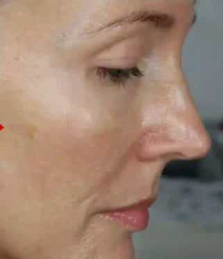 đ„ăđ2025 NEW YEAR HOT SALEđă5Pairs Instant Beauty Face Nutrition Wrinkle Removal Lift Sticker