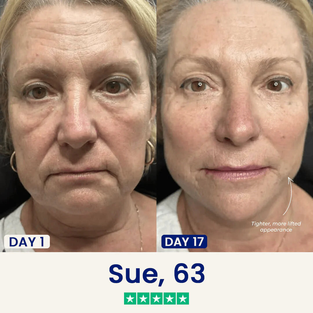 V-shaped lifting mask Nourishing skin hydrating mask