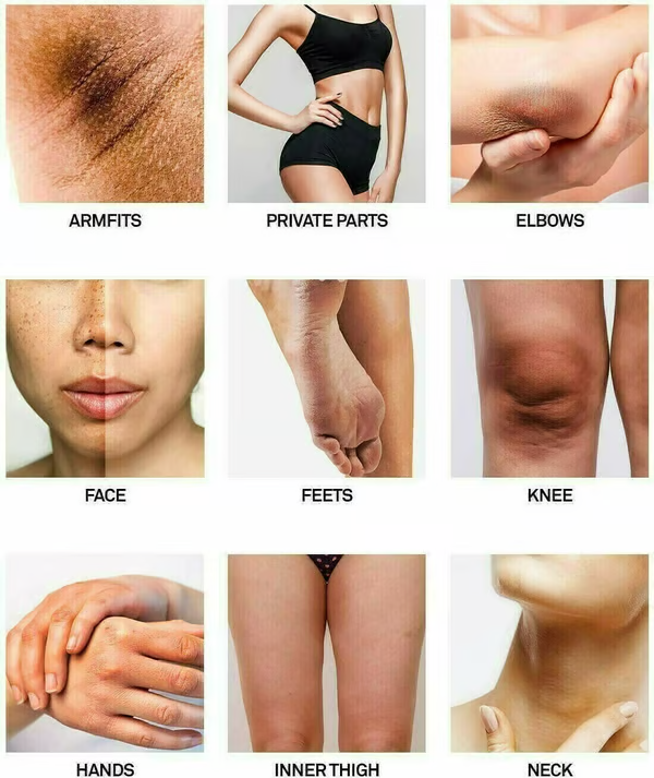 🔥Whitening Cream