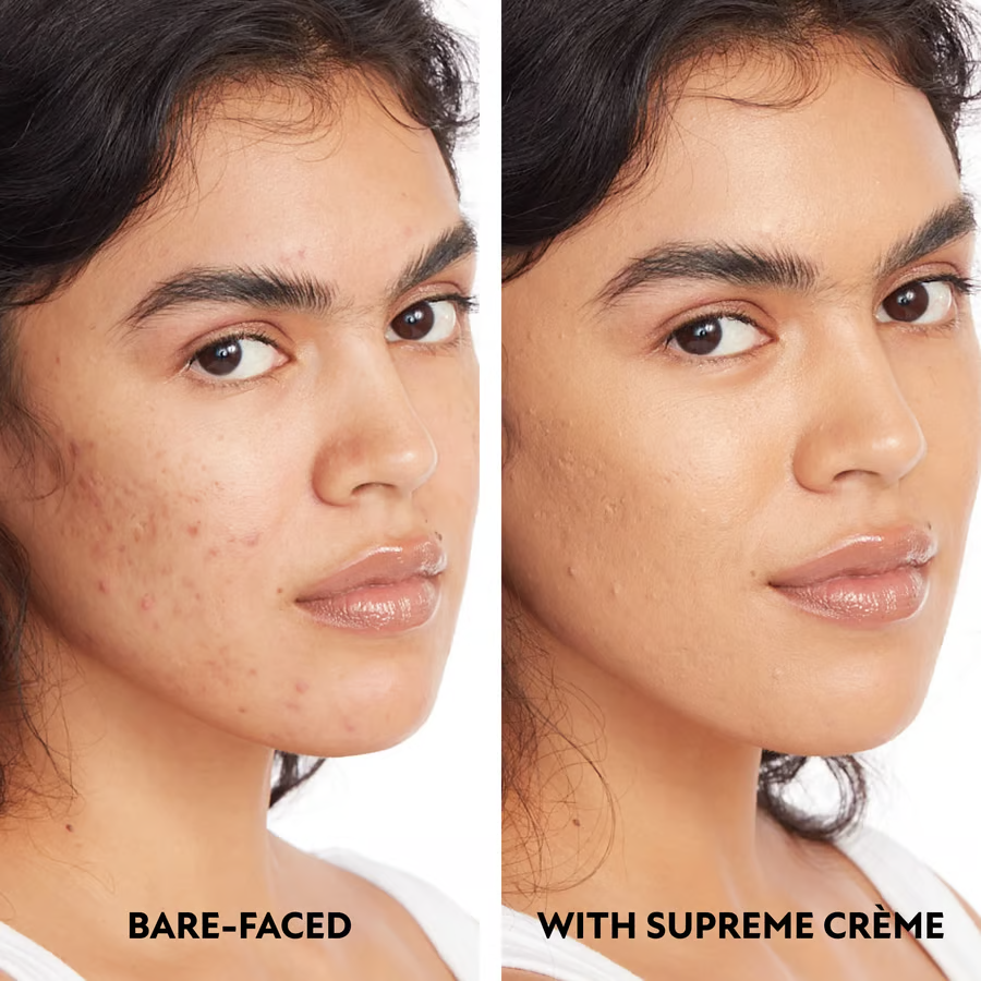 Beauty Supreme Crème - All-in-one moisturizer, concealer & coverage✨