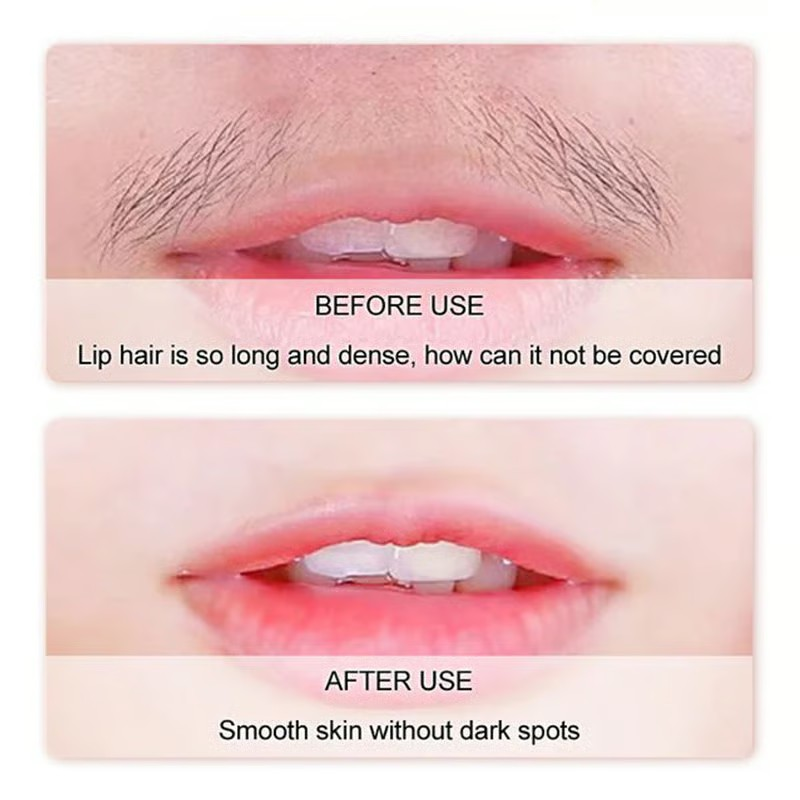 Gentle and Painless Facial Hair Removal Cream