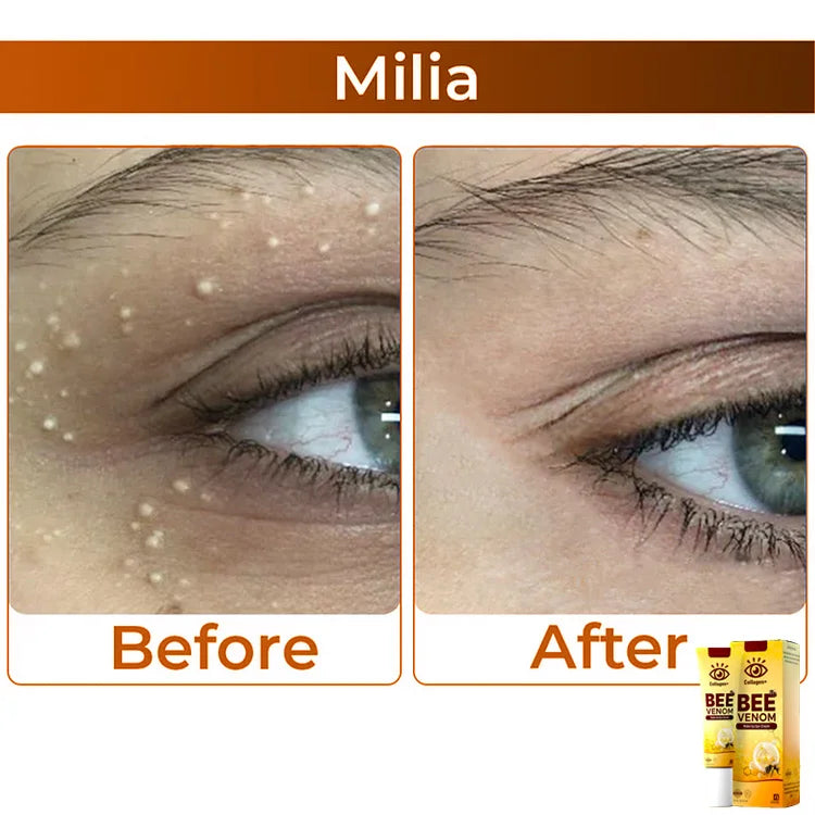 AnnieCare® Collagen+ Bee Venom Wake Up Eye Cream 👨⚕️ Dermatologist Approved