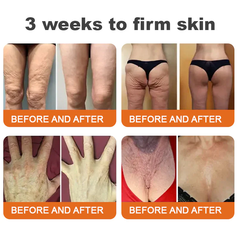 đđ
Flysmusâą Botox Bee Venom Firming Serum Stick-(Made and Shipped from Australia)-LAST DAY 70% OFF