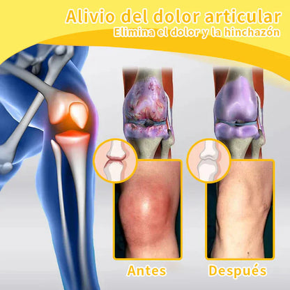 ODALIT™ Toxina Botulínica & Veneno de Abeja Alivio del Dolor Crema Cicatrizante de Huesos