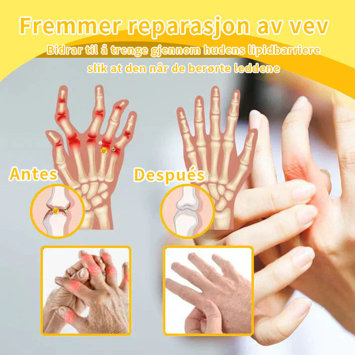 ODALIT™ Toxina Botulínica & Veneno de Abeja Alivio del Dolor Crema Cicatrizante de Huesos