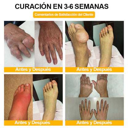 ODALIT™ Toxina Botulínica & Veneno de Abeja Alivio del Dolor Crema Cicatrizante de Huesos