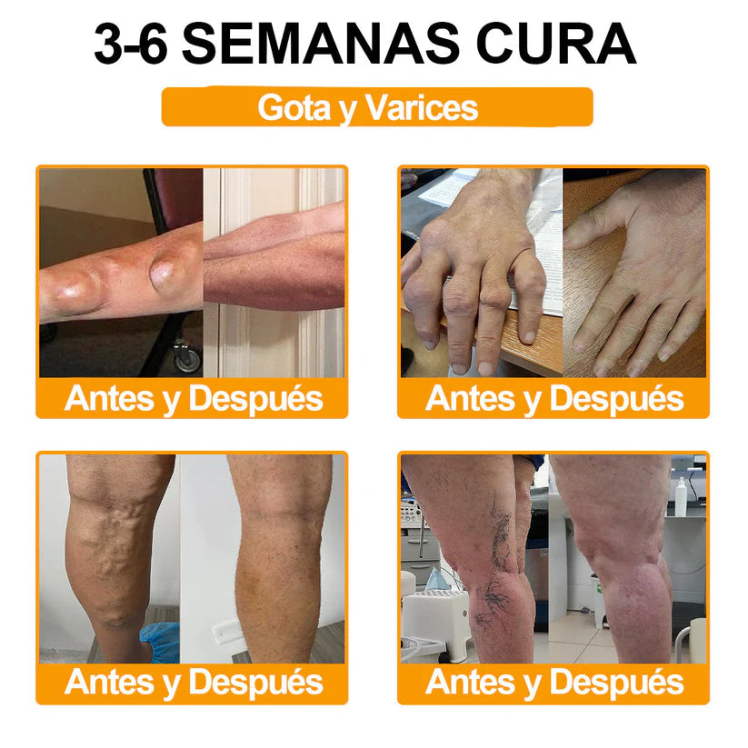 ODALIT™ Toxina Botulínica & Veneno de Abeja Alivio del Dolor Crema Cicatrizante de Huesos