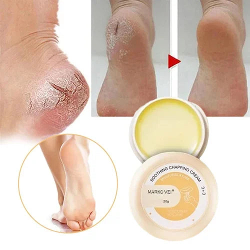 🎁SALE-49% OFF🎁Anti-Cracking Frost