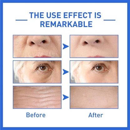 Last Day Promotion 49% OFF--2024 New Collagen Boost Anti-Aging Serum