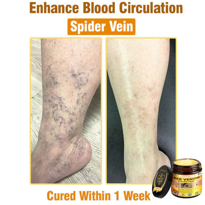 Bee Venom All-in-One Cream US Dermatologist Approved