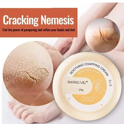 🎁SALE-49% OFF🎁Anti-Cracking Frost