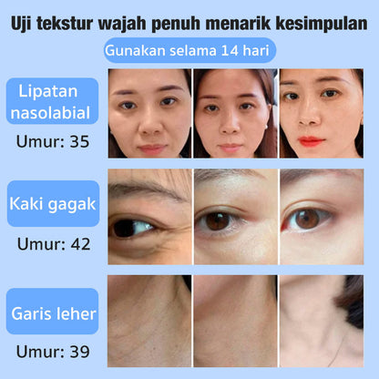 🎉Last Day Promotion - 49% OFF🎉Japanese Anti-wrinkle Rejuvenation Cream