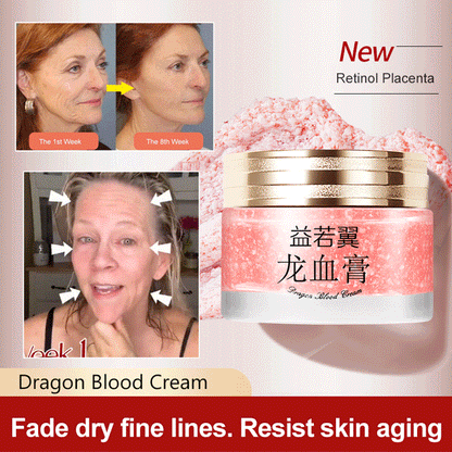 2024 NEW DRAGONS BLOOD EASY CREAM (BUY 3 GET3 FREE)