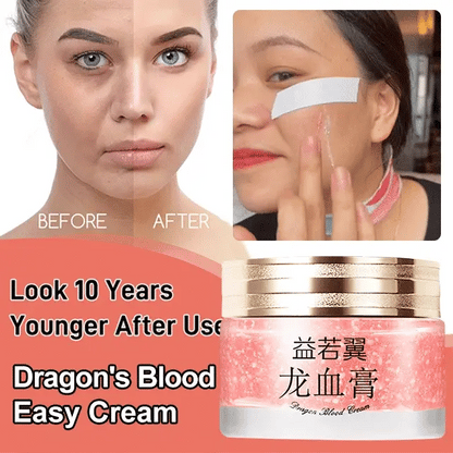 2024 NEW DRAGONS BLOOD EASY CREAM (BUY 3 GET3 FREE)