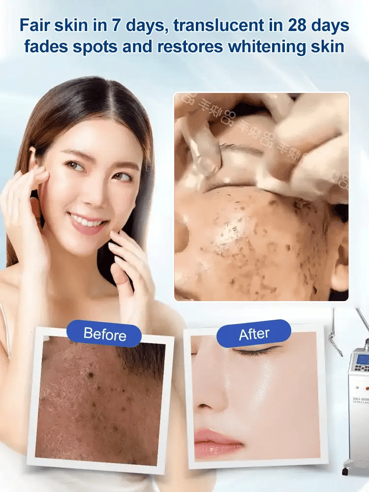 🎁2025 Hot Sale🎁Spot Fading Urea Cream