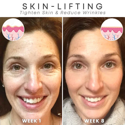 🎉Buy 1 Get 1 Free🎁 - Botox Face Serum