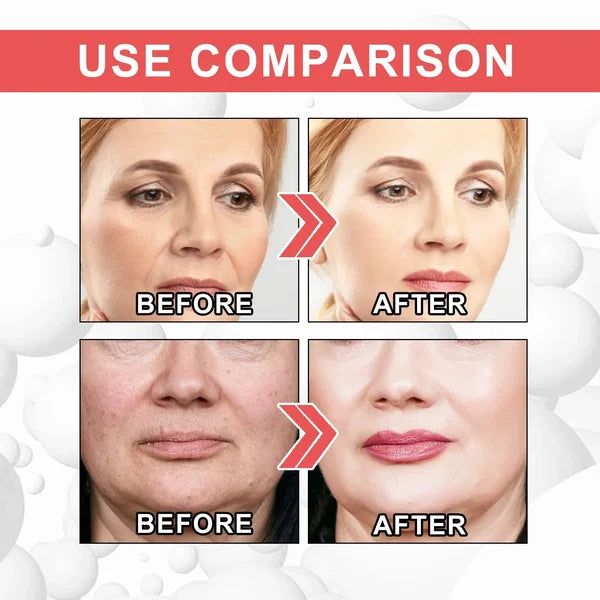 Last Day Promotion 49% OFF--2024 New Collagen Boost Anti-Aging Serum
