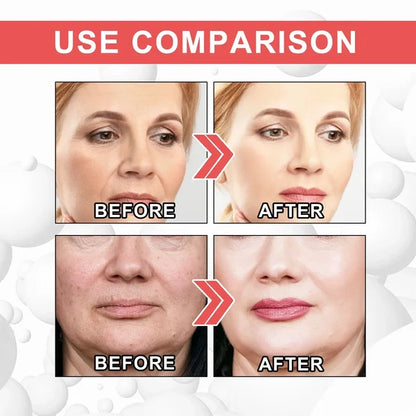 Last Day Promotion 49% OFF--2024 New Collagen Boost Anti-Aging Serum