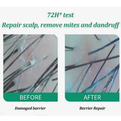 Anti-Dandruff Artemisia Conditioner-【BUY 2 GET 1 FREE】