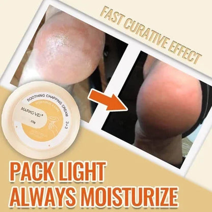 🎁SALE-49% OFF🎁Anti-Cracking Frost