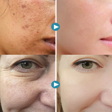 🔥 Last Day 49% OFF-2025 New Magical Perfecting Base Face Primer Under Foundation