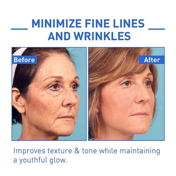 🎉Buy 1 Get 1 Free🎁 - Botox Face Serum