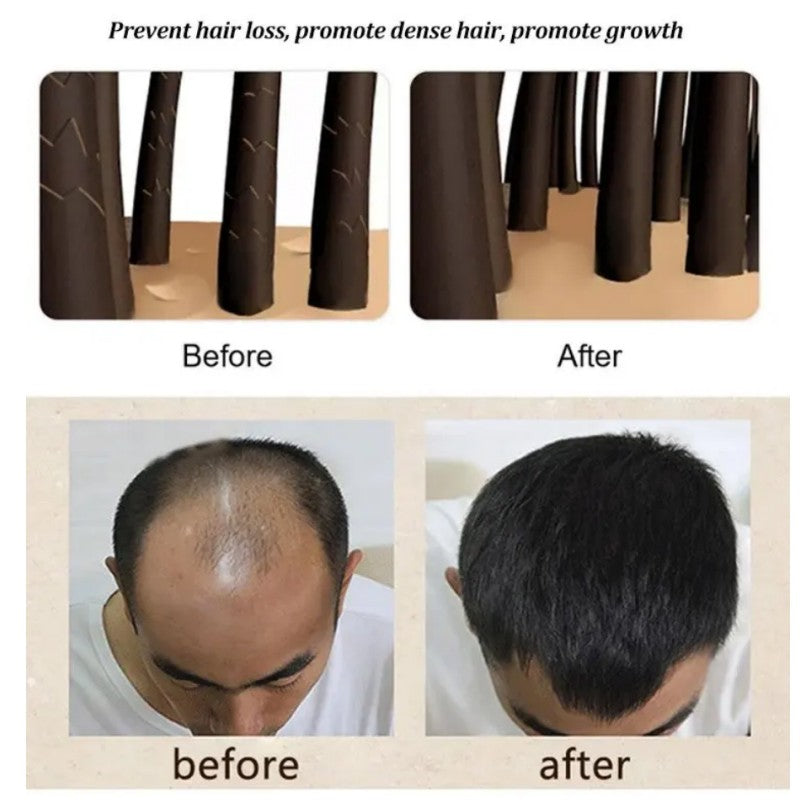 Anti-Dandruff Artemisia Conditioner-【BUY 2 GET 1 FREE】