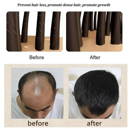Anti-Dandruff Artemisia Conditioner-【BUY 2 GET 1 FREE】