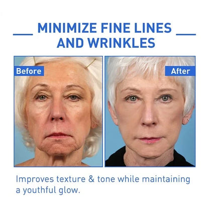 🎉Buy 1 Get 1 Free🎁 - Botox Face Serum