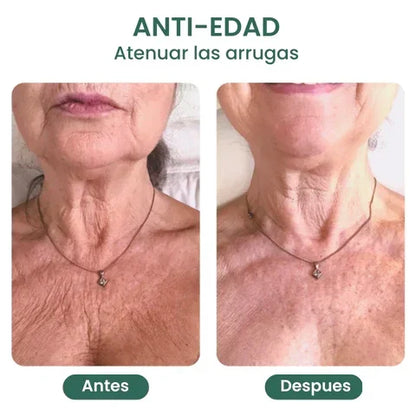Hydrolized Collagen Neck Cream