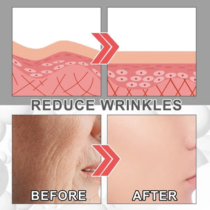 Last Day Promotion 49% OFF--2024 New Collagen Boost Anti-Aging Serum