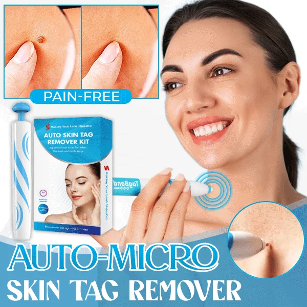 Auto Micro Skin Tag Remover🎁