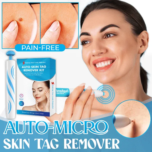 Auto Micro Skin Tag Remover🎁