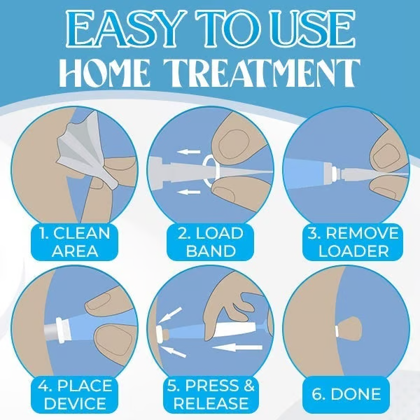 Auto Micro Skin Tag Remover🎁