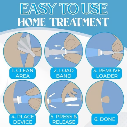Auto Micro Skin Tag Remover🎁