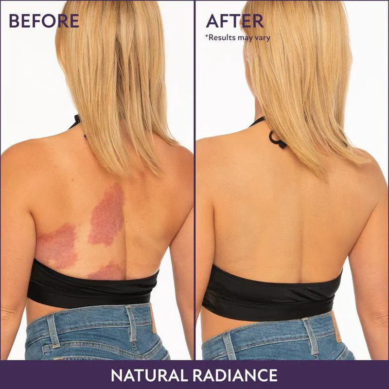 ✨Body Coverage Perfector – Waterproof, lightweight & flawless body makeup