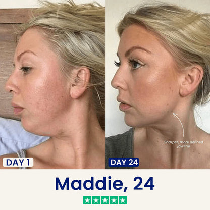 V-shaped lifting mask Nourishing skin hydrating mask