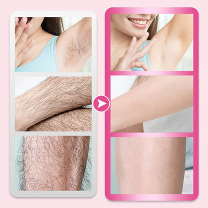 🎁LAST DAY-BUY2 GET 1 FREE🎁Flawless & Gentle Hair Removal Cream